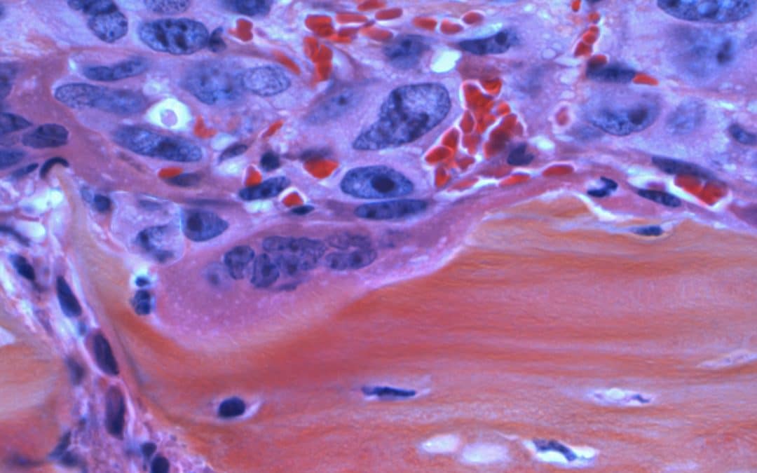 Terapie oncologiche e tossicità cutanea